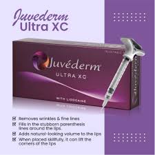 Alternative view of Juvederm Ultra XC